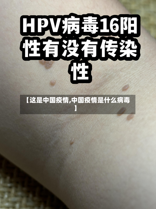 【这是中国疫情,中国疫情是什么病毒】