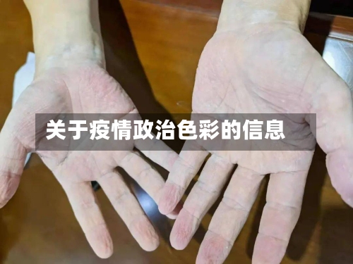 关于疫情政治色彩的信息-第2张图片
