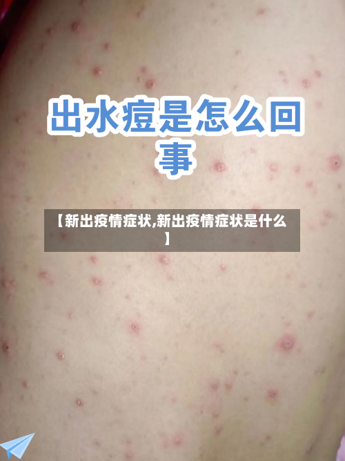 【新出疫情症状,新出疫情症状是什么】-第2张图片