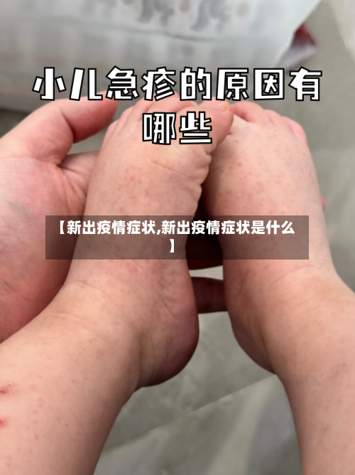 【新出疫情症状,新出疫情症状是什么】-第3张图片